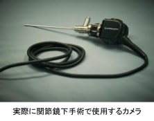 実際に使用する関節鏡