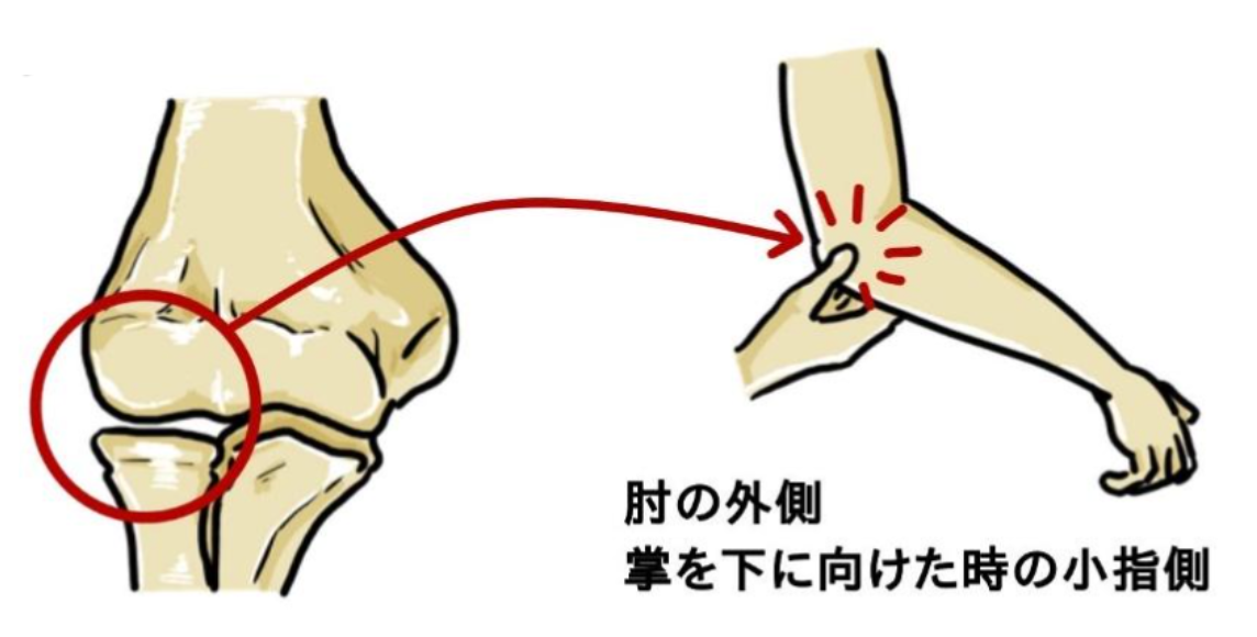 ふなせいの医師が解説 野球肘の症状と治療法 ふなせいトピックス 船橋整形外科 市川クリニック Funabashi Orthopedic Ichikawa Clinic
