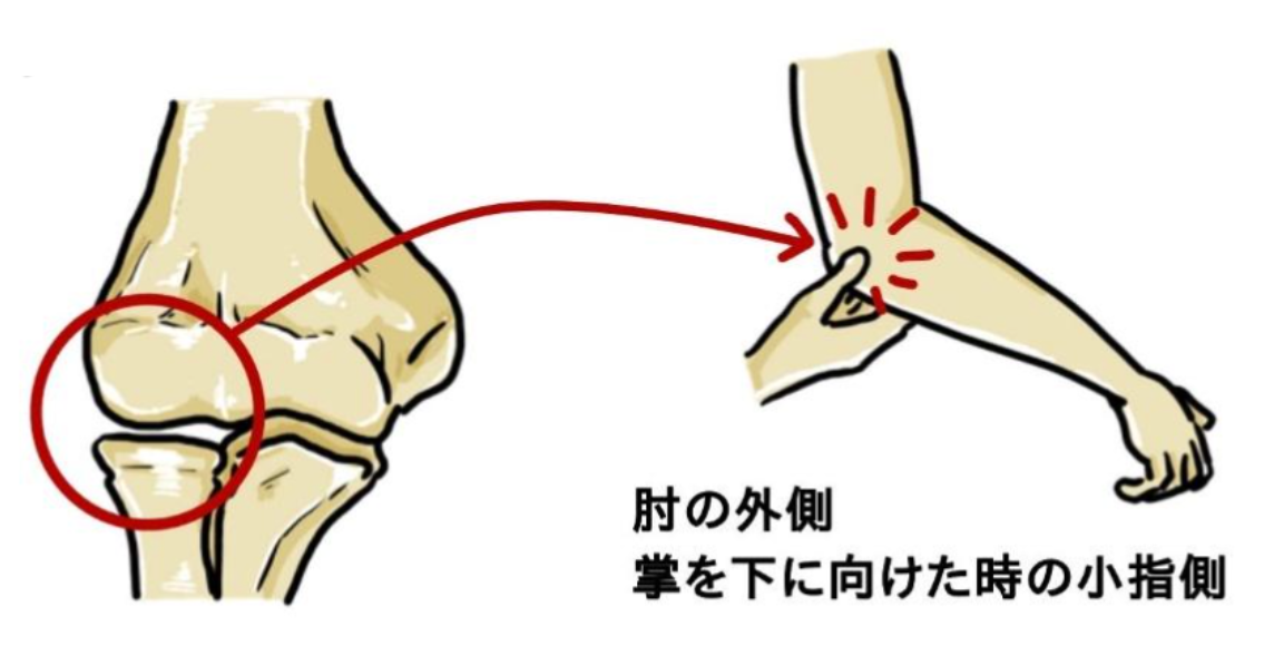 肘 の 内側 が 痛い 野球