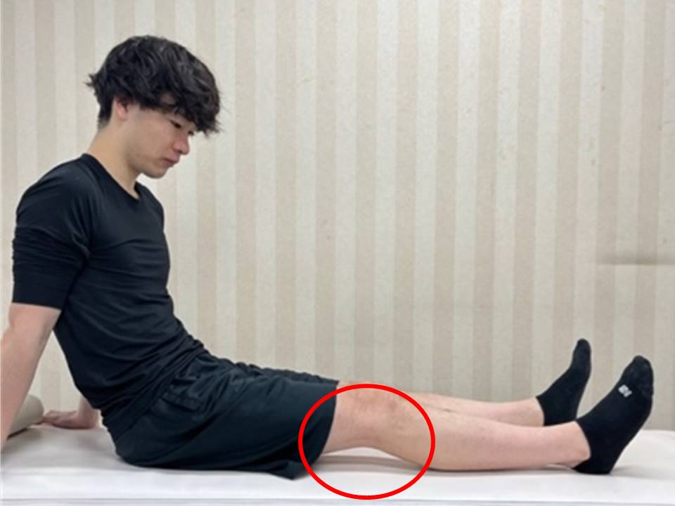 膝関節伸展テスト