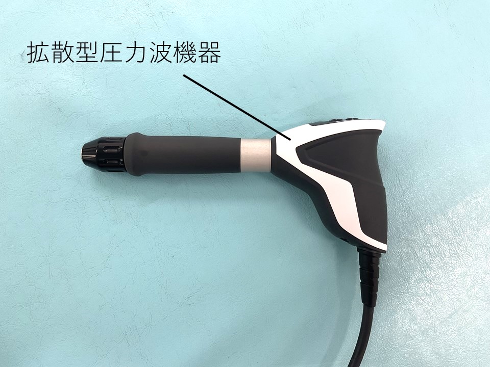 写真9拡散型圧力波の治療例①