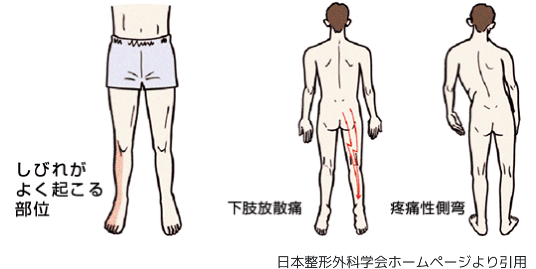 腰椎疾患 船橋整形外科病院 Funabashi Orthopedic Hospital